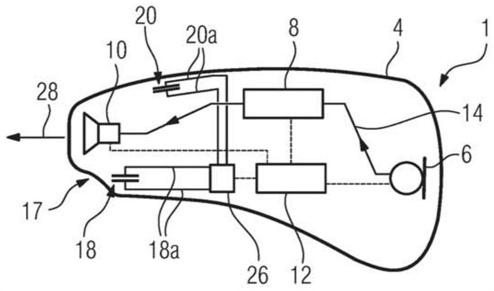 Hearing device with earplugs