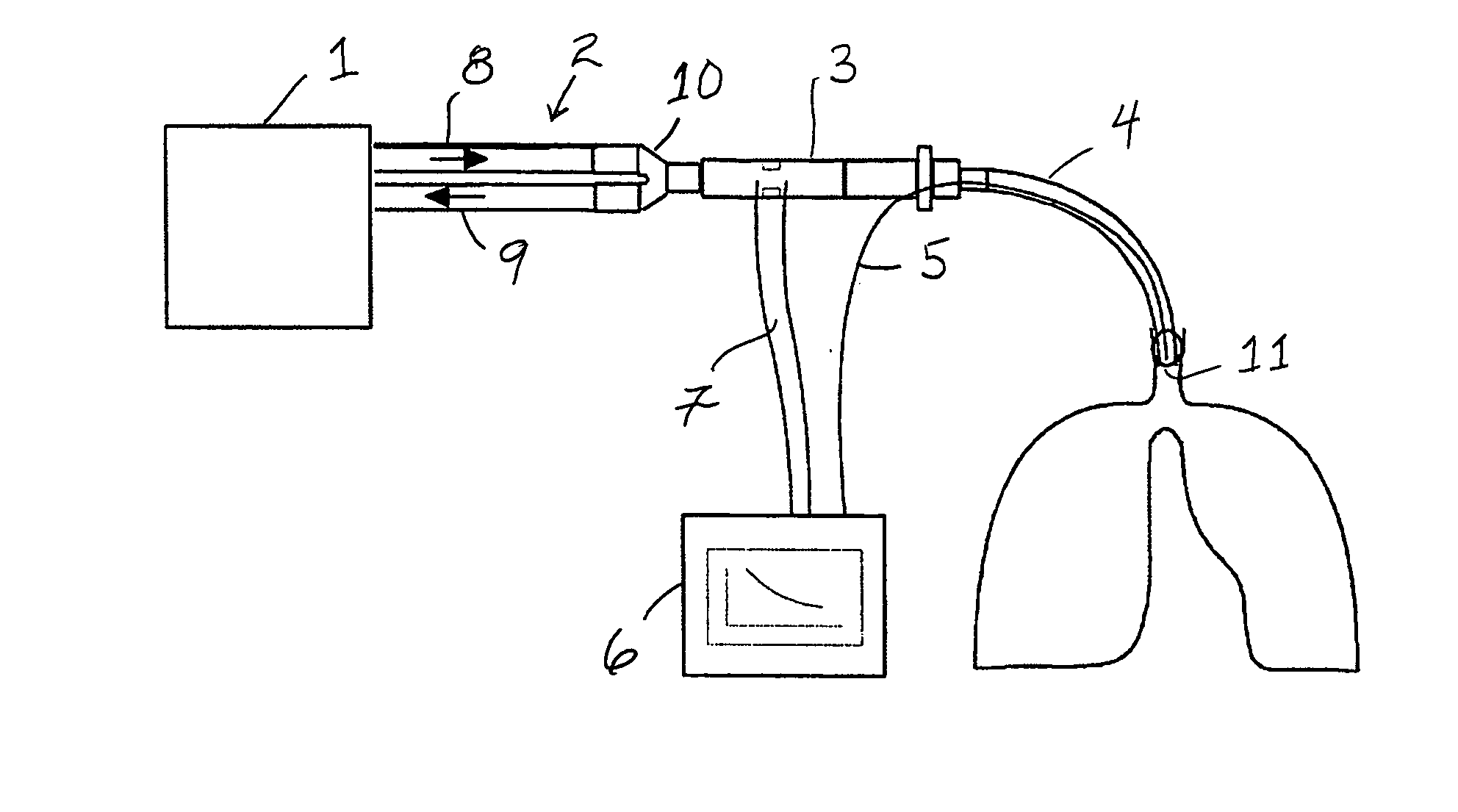 Method for monitoring lung collapse