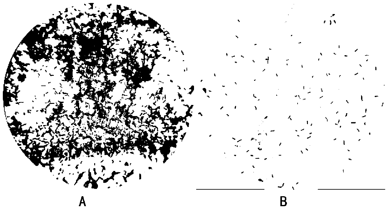 Slide preparation method of bacterial staining method and application of slide preparation method