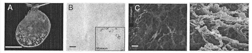 Implantable bioartificial liver