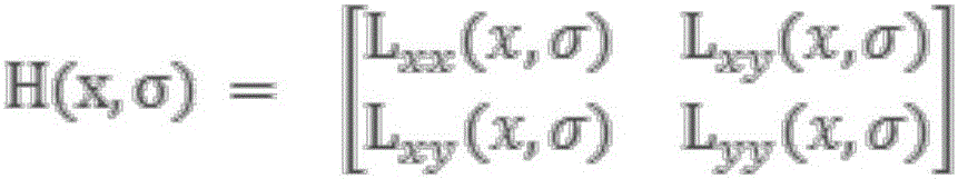 Multimode medical image registration method based on SURF algorithm