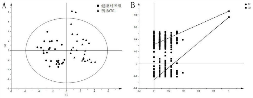 Application of Myristic Acid and Glycerin Composition in Evaluating the Curative Effect of Chronic Myelogenous Leukemia TKI