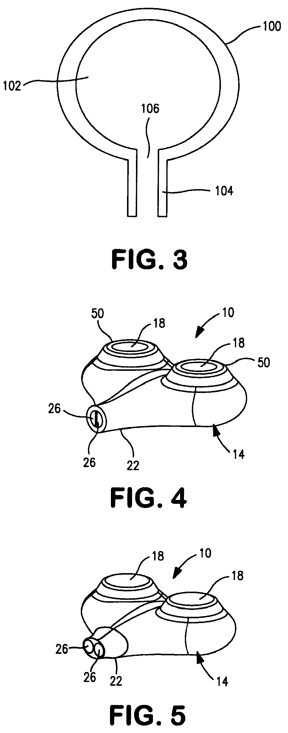 Implantable catheter port