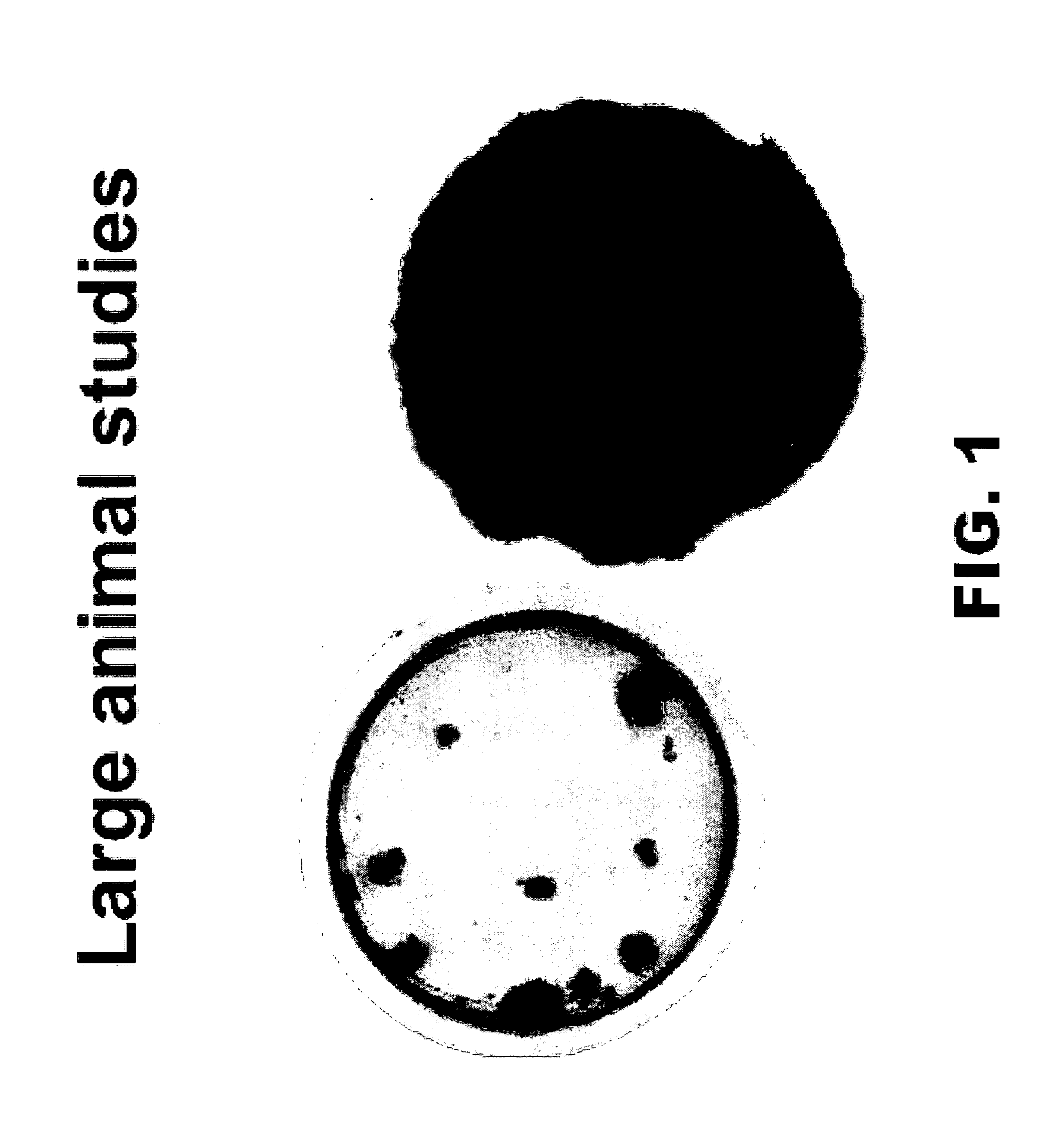 Multi-membrane immunoisolation system for cellular transplant