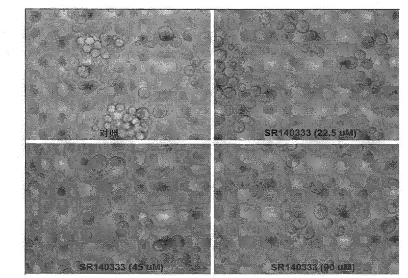 Anti-leukemia effects of SR140333