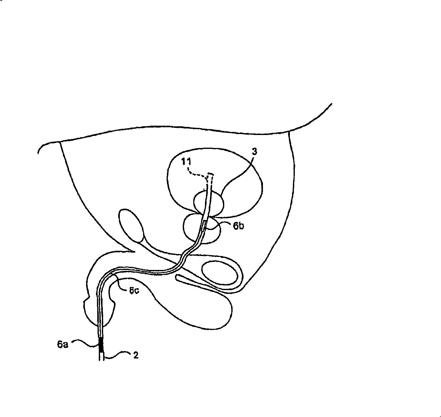 Method and apparatus for photoactivation medicament treatment