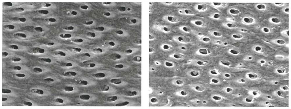 Oral care composition containing bioactive material and spherical silicon dioxide