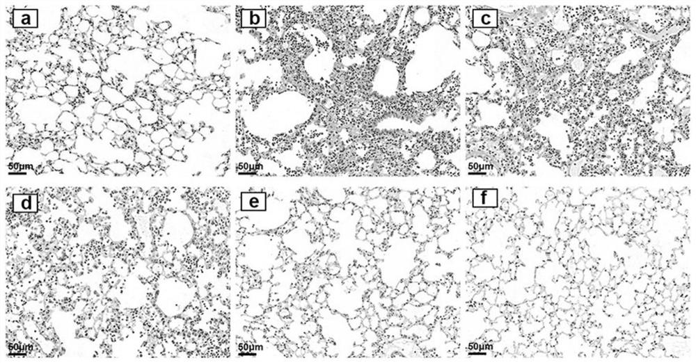 Traditional Chinese medicine composition for treating acute lung injury/acute respiratory distress syndrome and application thereof