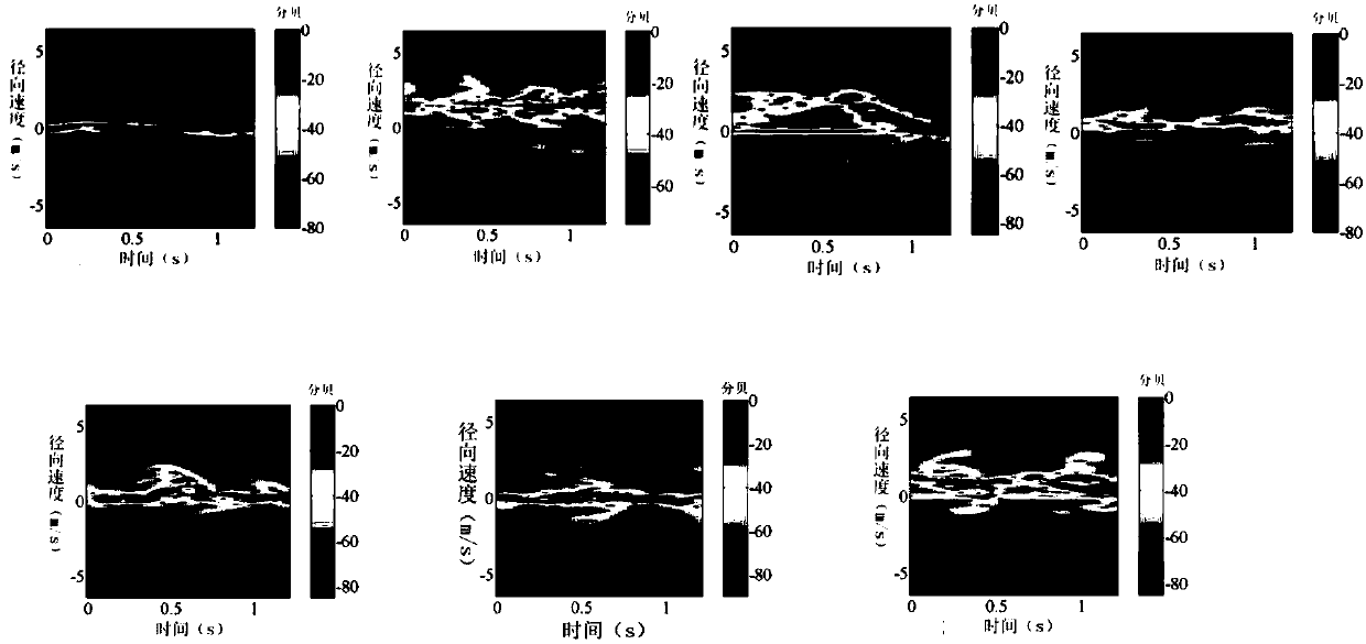 Human motion open-set identification method based on radar image and generation countermeasure model