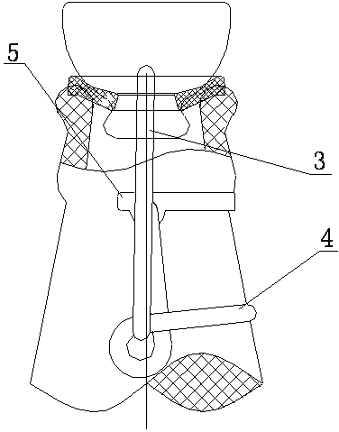 Sealed bottle cap with opening device