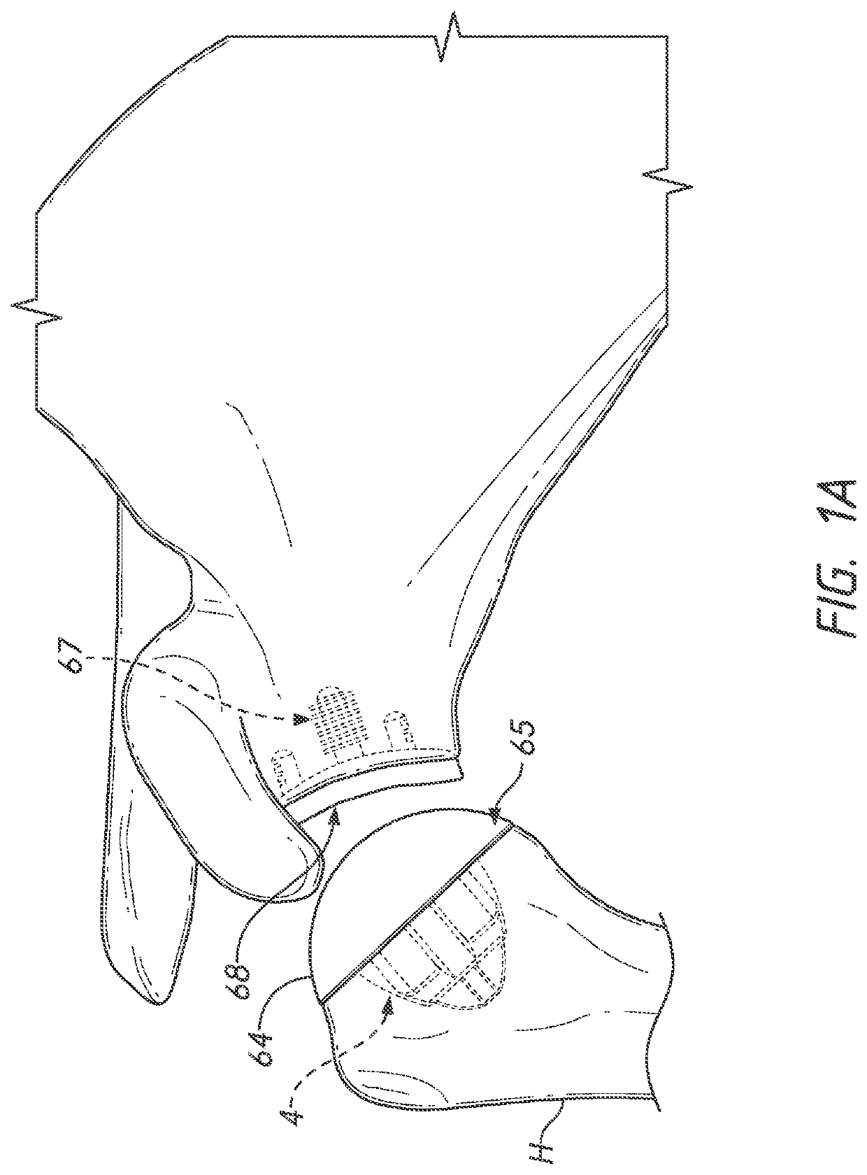 Shoulder prosthesis components and assemblies