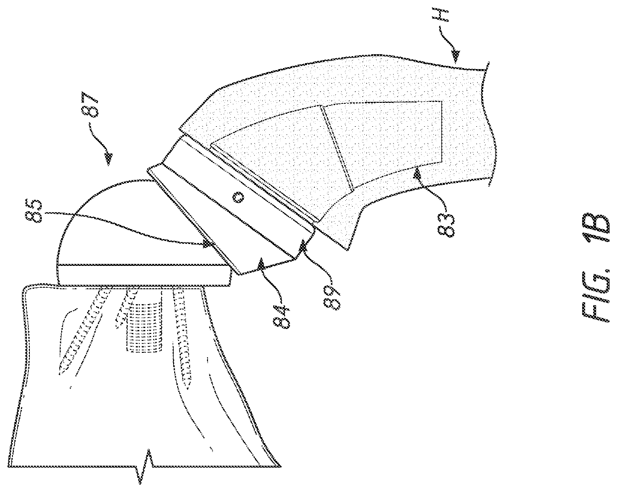 Shoulder prosthesis components and assemblies