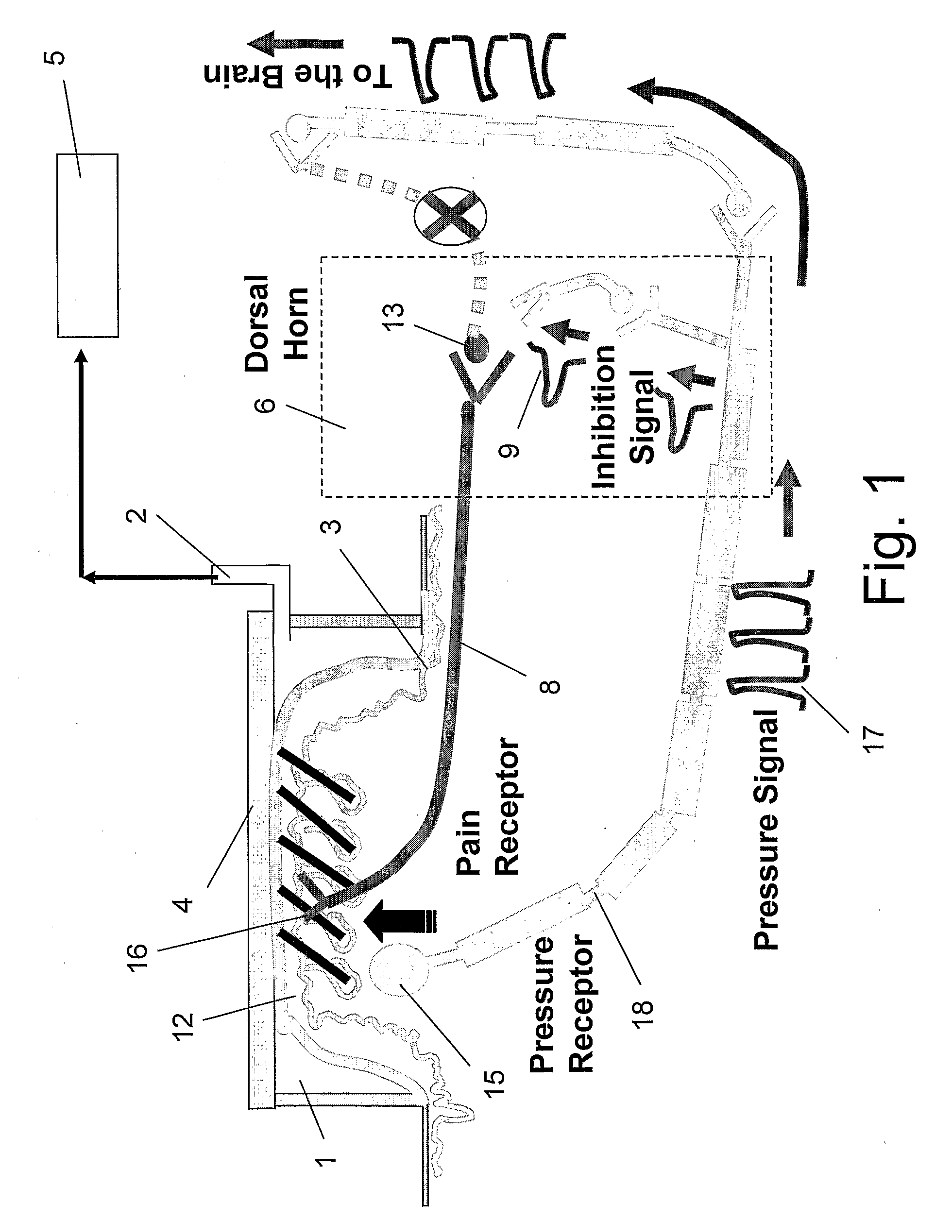 Method and Apparatus for Inhibiting Pain Signals During Vacuum-Assisted Medical Treatments of the Skin