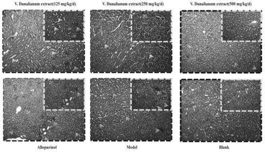 Method for extracting vaccinium dunalianum extract by eutectic solvent method, and preparation and application of granules