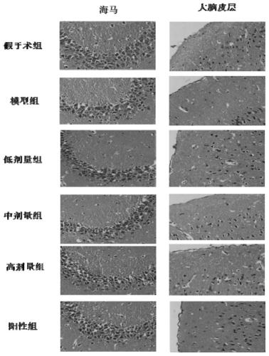 Application of ramulus et folium picrasmae extract to preparing medicines or healthcare products for preventing and treating neurodegenerative diseases