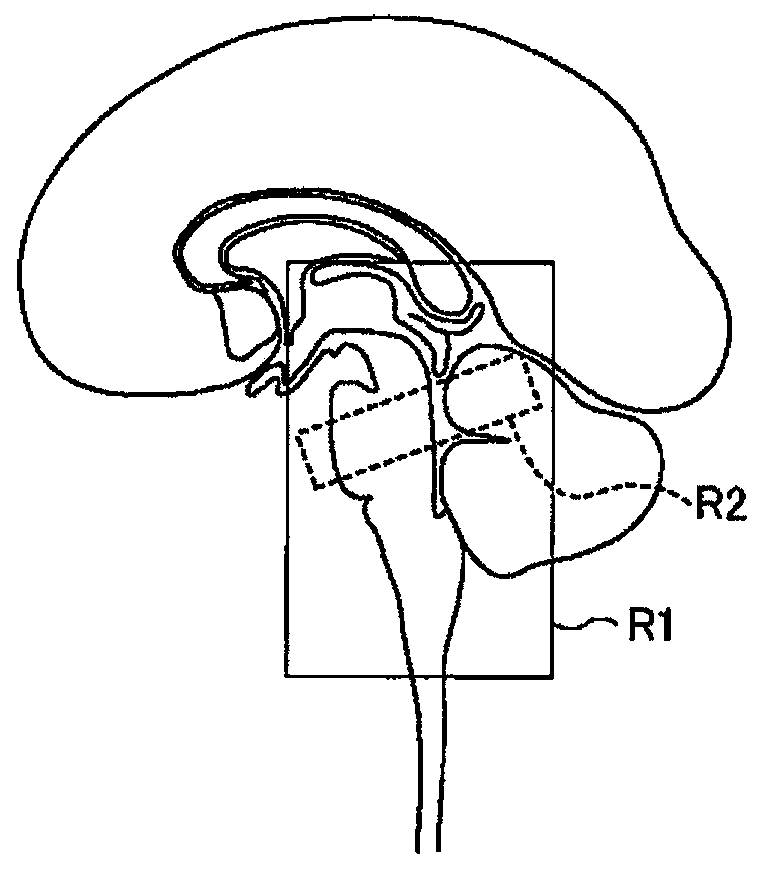 Magnetic resonance imaging apparatus and method