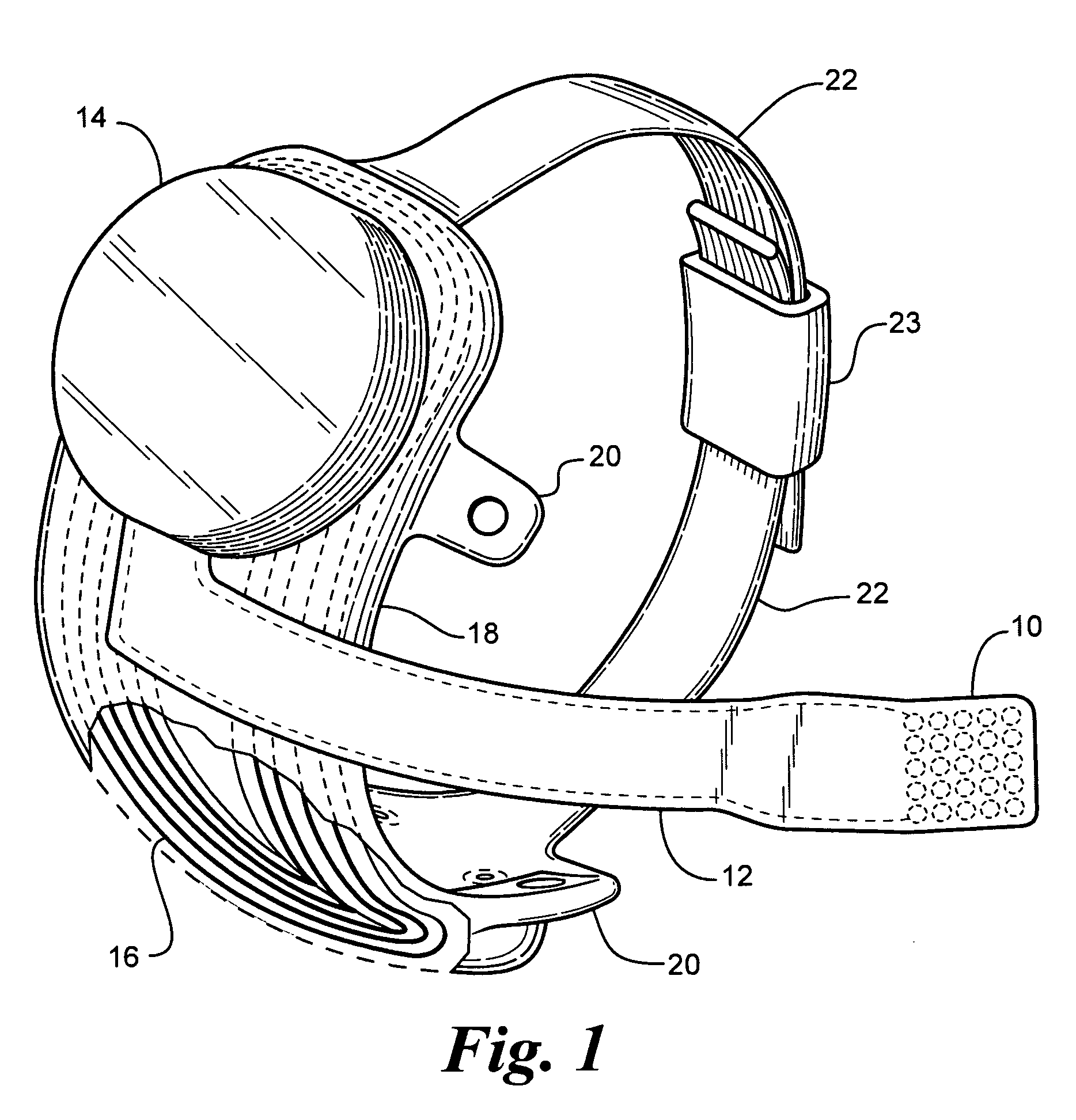 Retinal prosthesis