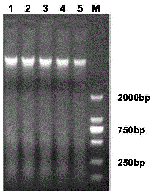 Sudden cardiac death mutant gene detection kit