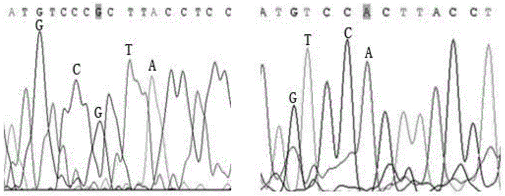 Sudden cardiac death mutant gene detection kit