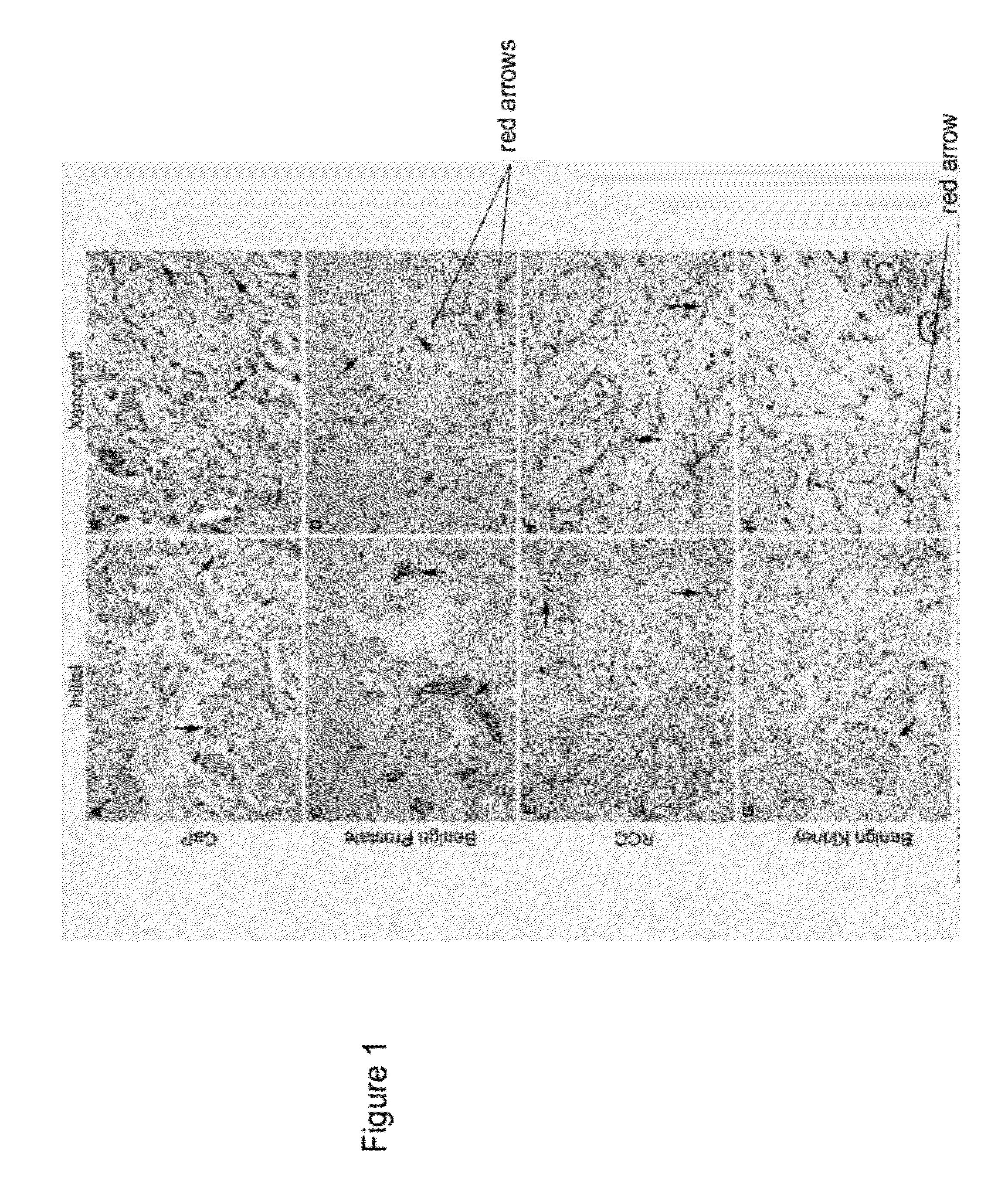 Methods For Evaluating and Implementing Prostate Disease Treatments