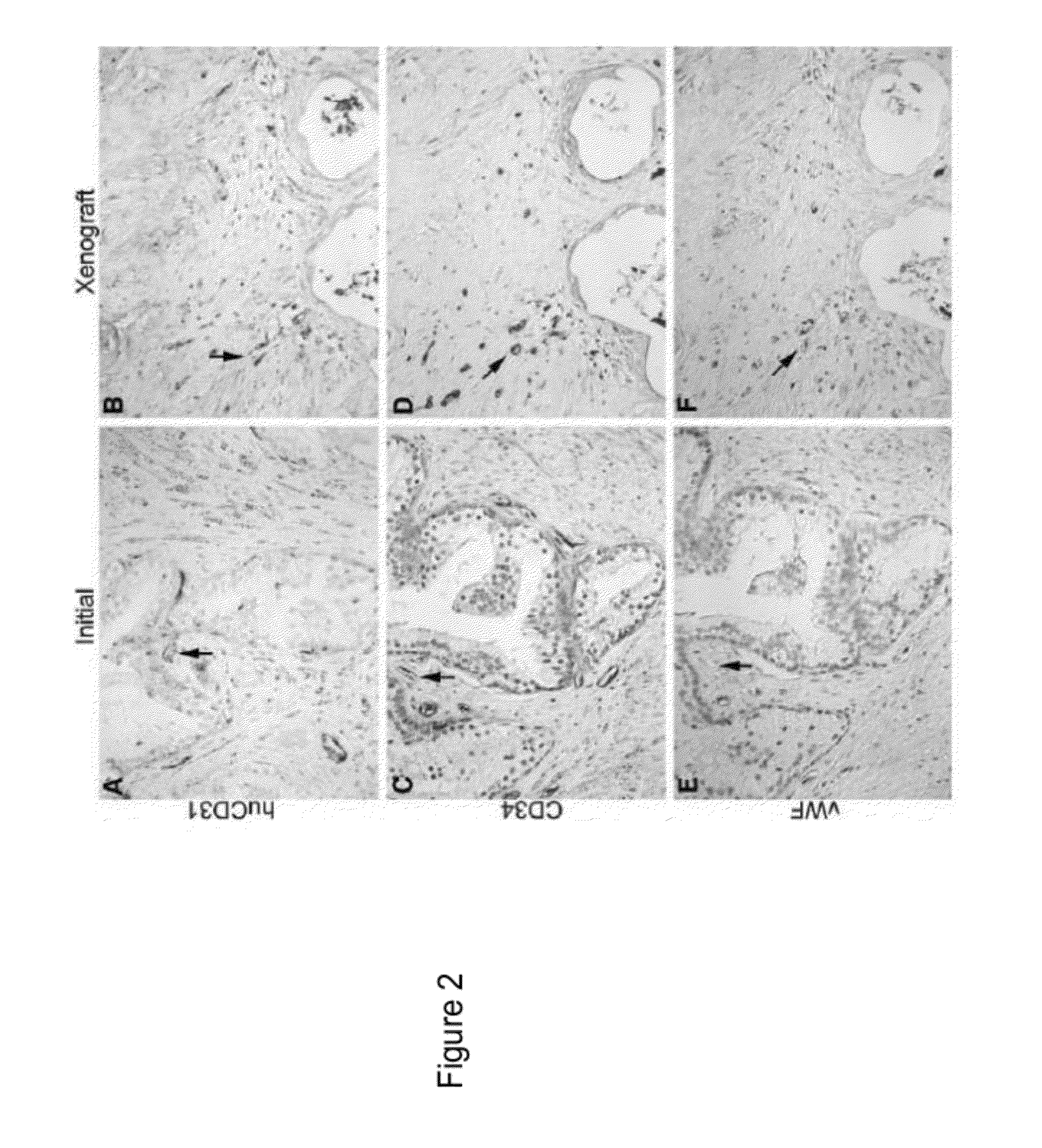 Methods For Evaluating and Implementing Prostate Disease Treatments