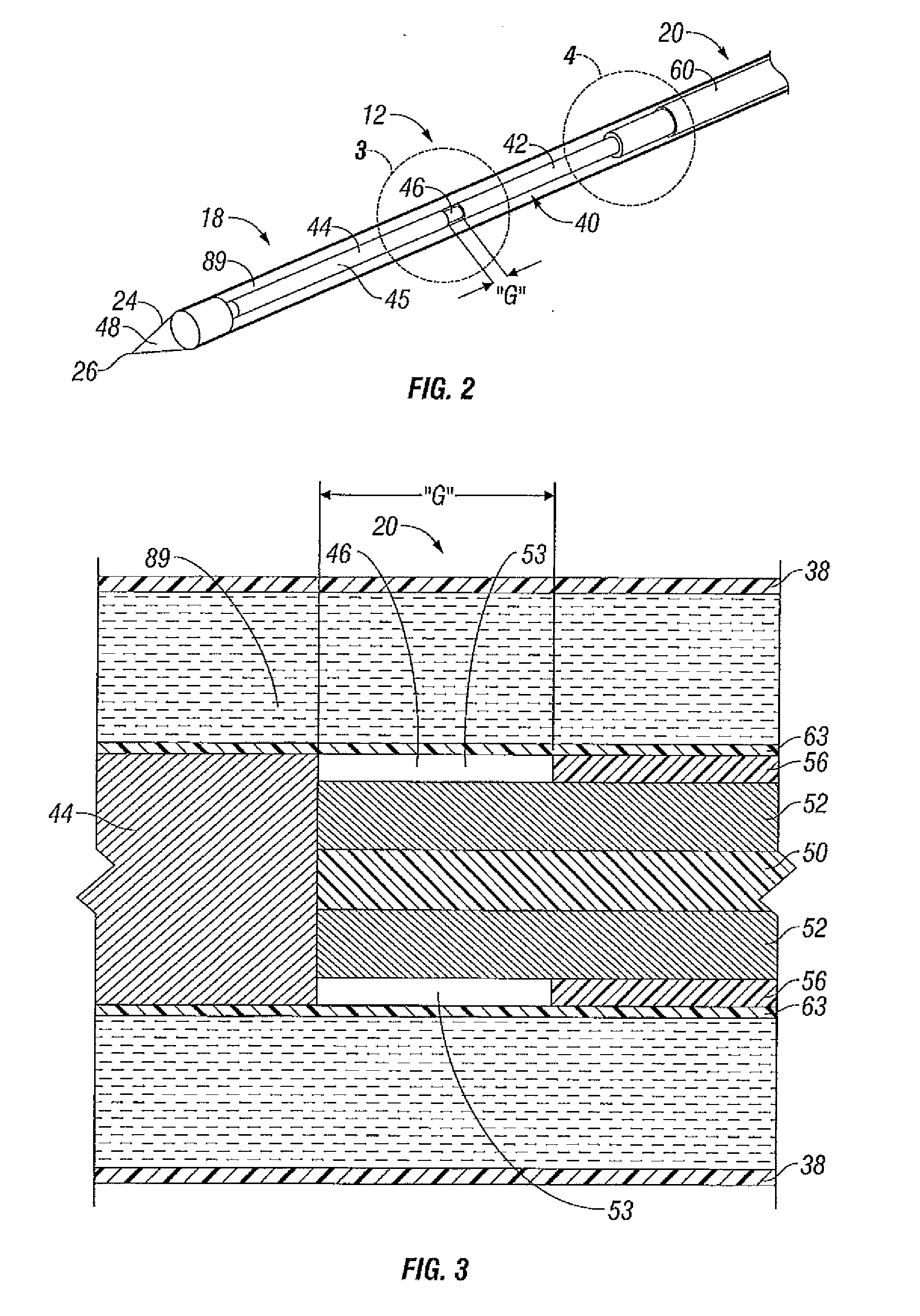 System and Method for Performing an Ablation Procedure