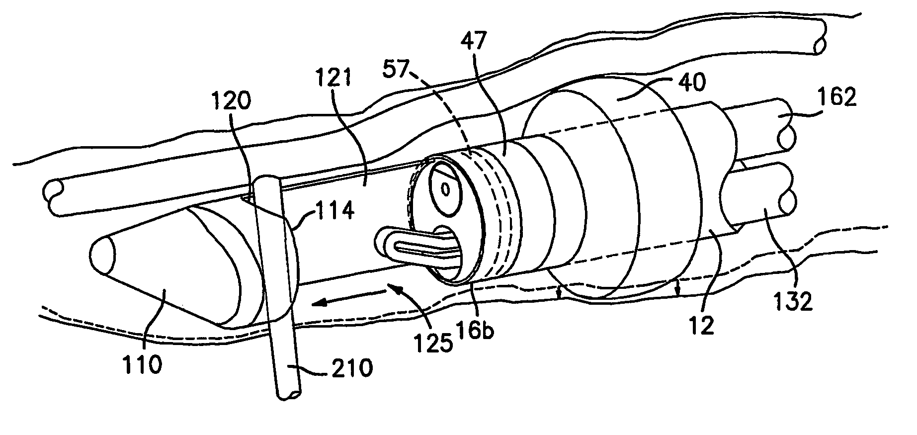 Conduit harvesting instrument and method