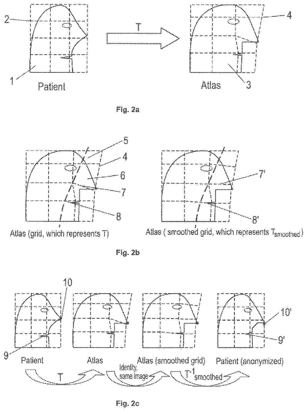 Anonymisation of medical patient images using an atlas