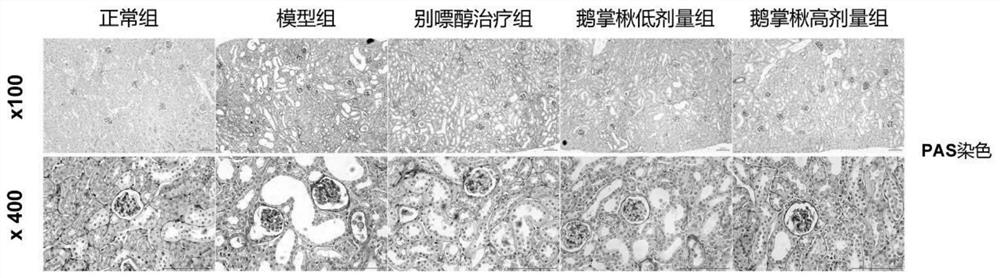 Use of Liriodendron tulipifera or its extract in preparing medicine for reducing serum uric acid level and preventing and treating uric acid nephropathy