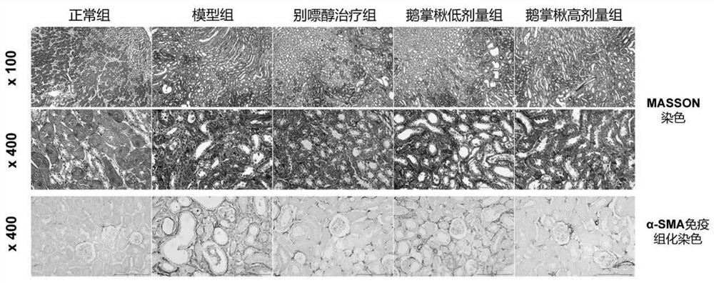 Use of Liriodendron tulipifera or its extract in preparing medicine for reducing serum uric acid level and preventing and treating uric acid nephropathy