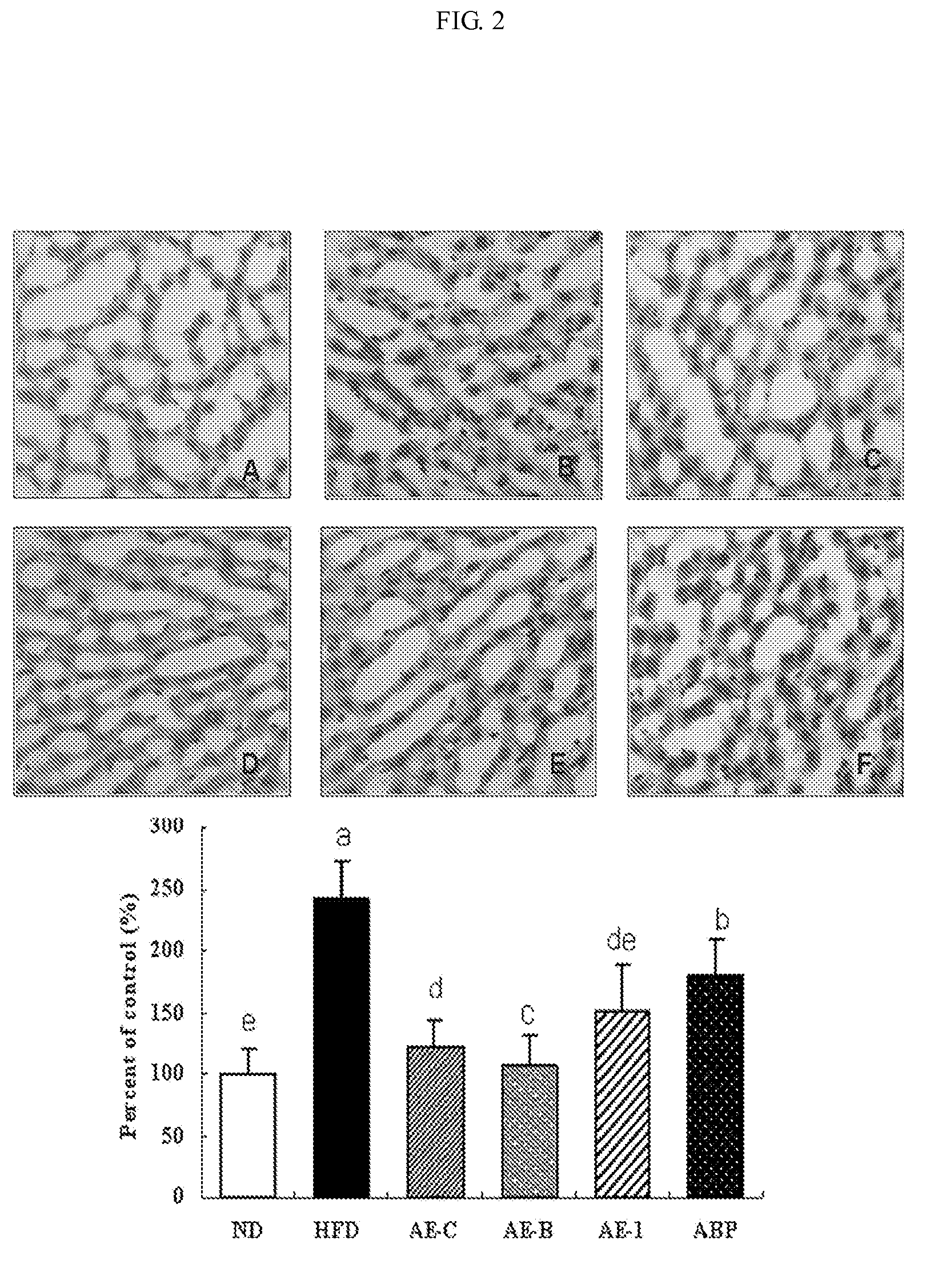 Method For Preparing Extract For The Prevention and Treatment Of Hyperlipidemia and Obesity From the Extract of Aster Spathulifolius Aerial Part and Composition Containing The Same