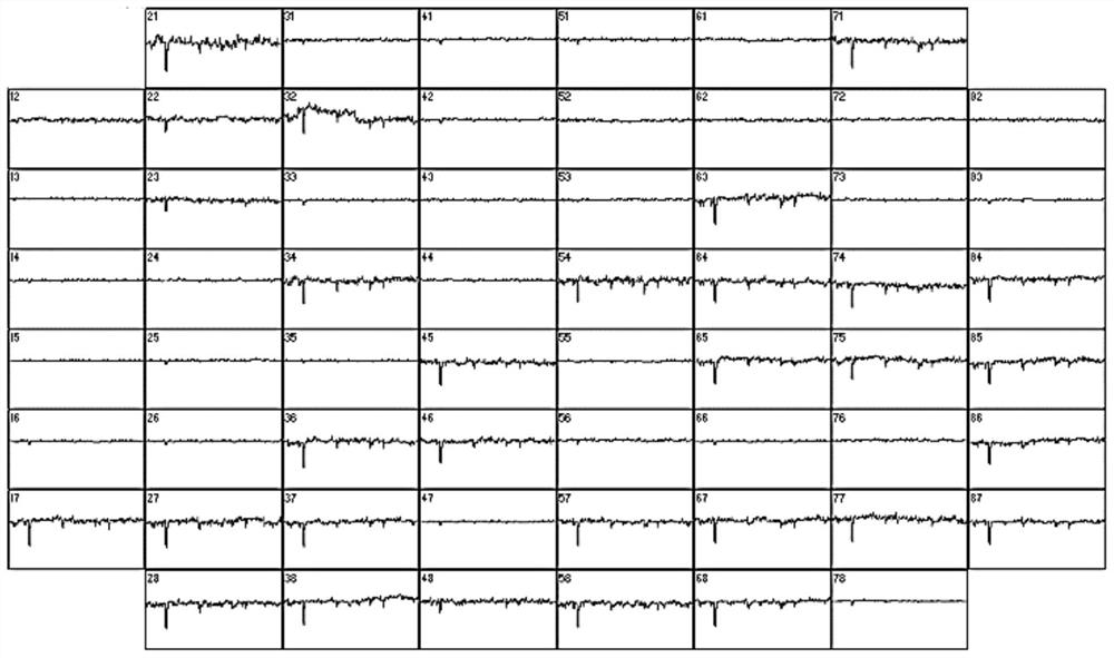 A method for synchronously monitoring chemical signals and electrical signals of nerve cell network