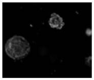 Novel lung intelligent drug release system