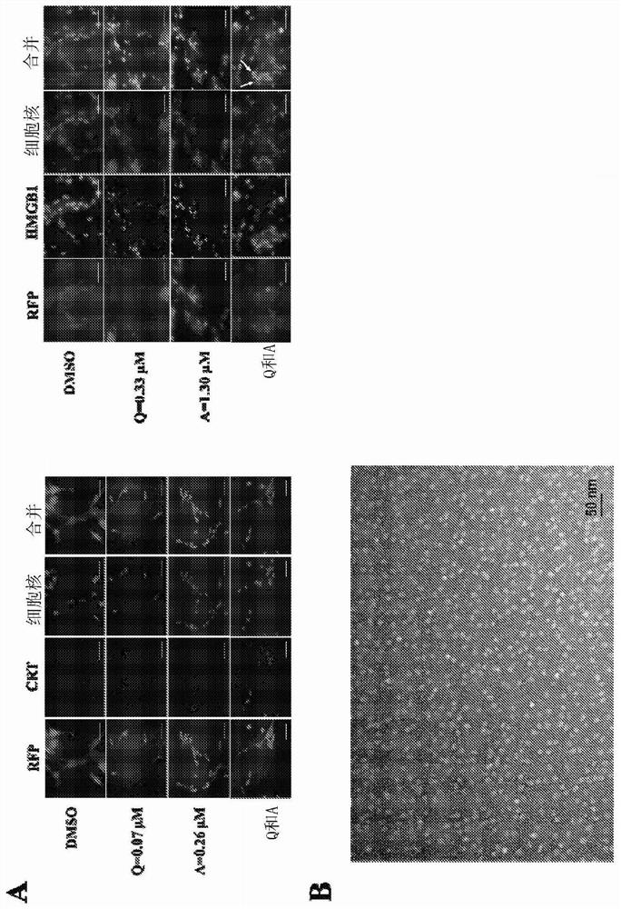 NANO co-delivery of quercetin and alantolactone promotes Anti-tumor response through synergistic immunogenic cell death for microsatellite-stable colorectal cancer