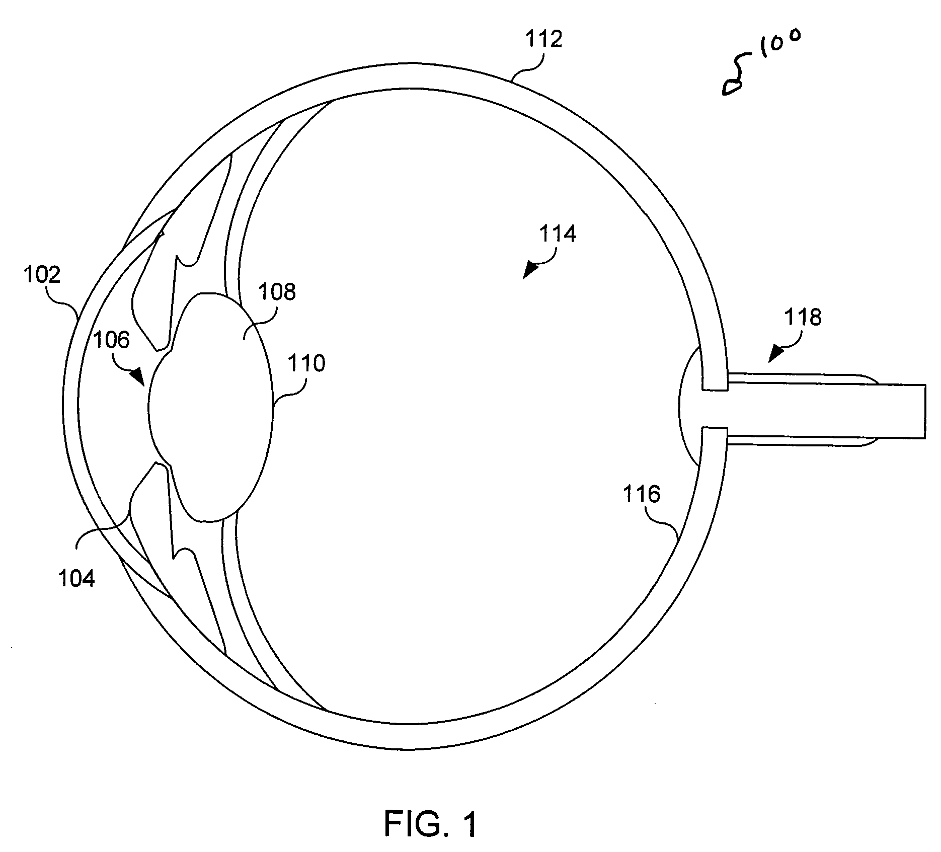 Non-invasive power adjustable intraocular lens