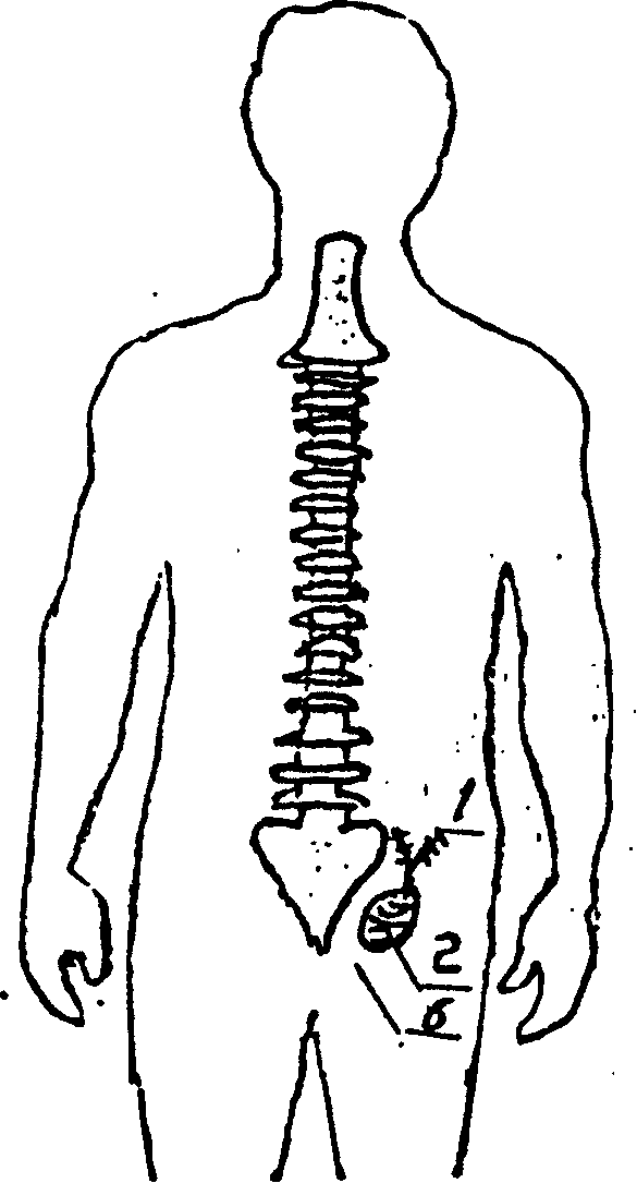 Biological affinitic electrode stimulating device