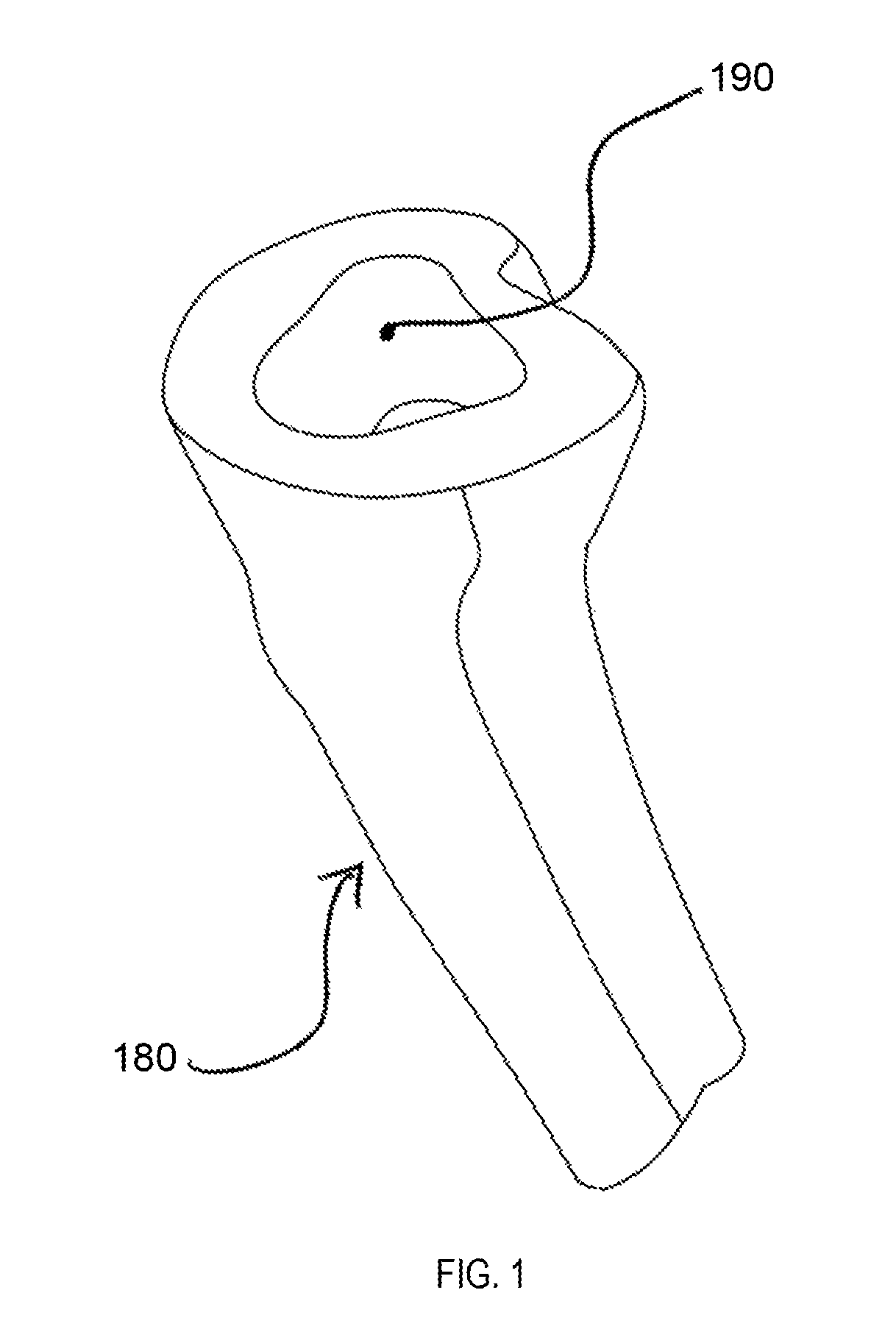 Prosthetic knee void filers with splined fixation