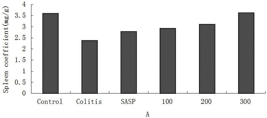 Application of licoflavone extract in preparation of medicine for treating ulcerative colitis