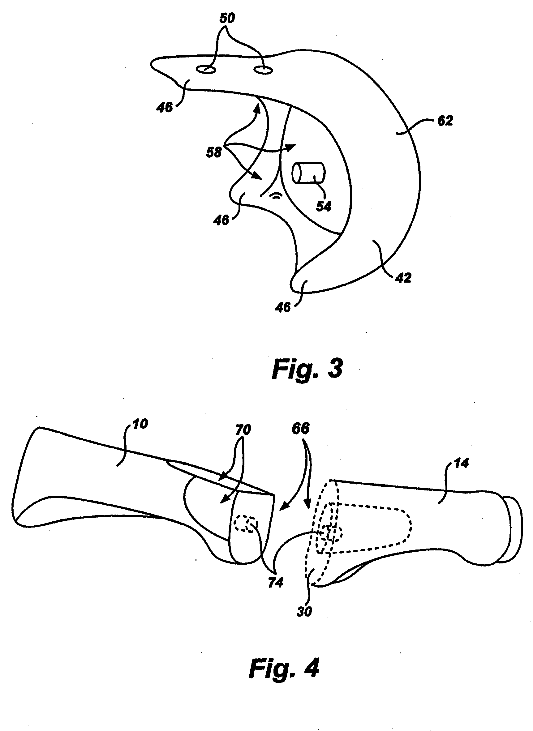 Artificial toe joint