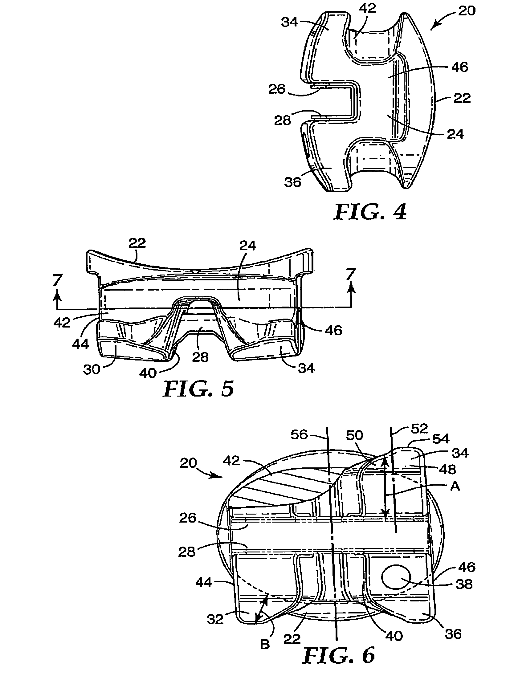 Orthodontic bracket with reinforced tiewings