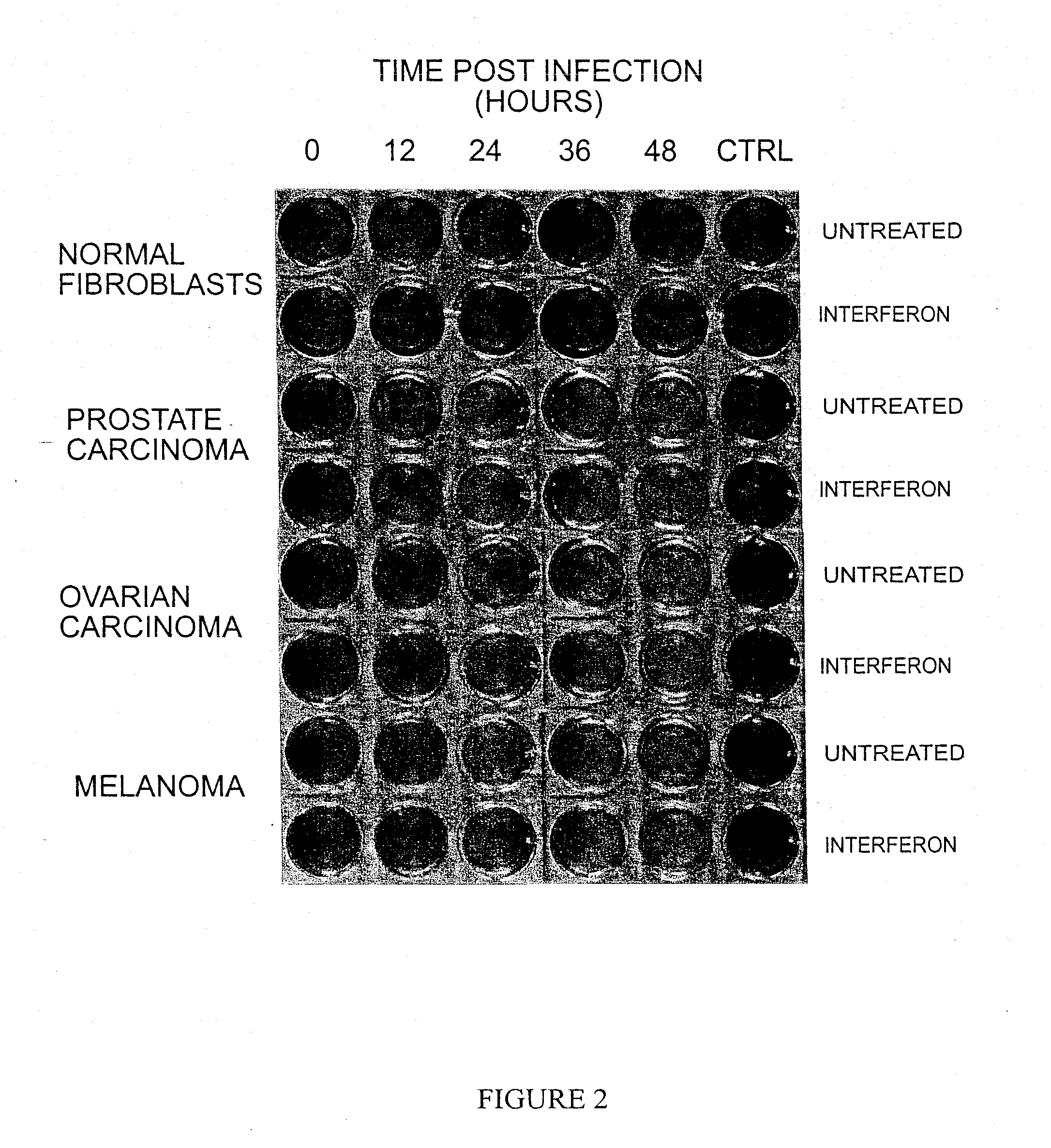 Oncolytic virus