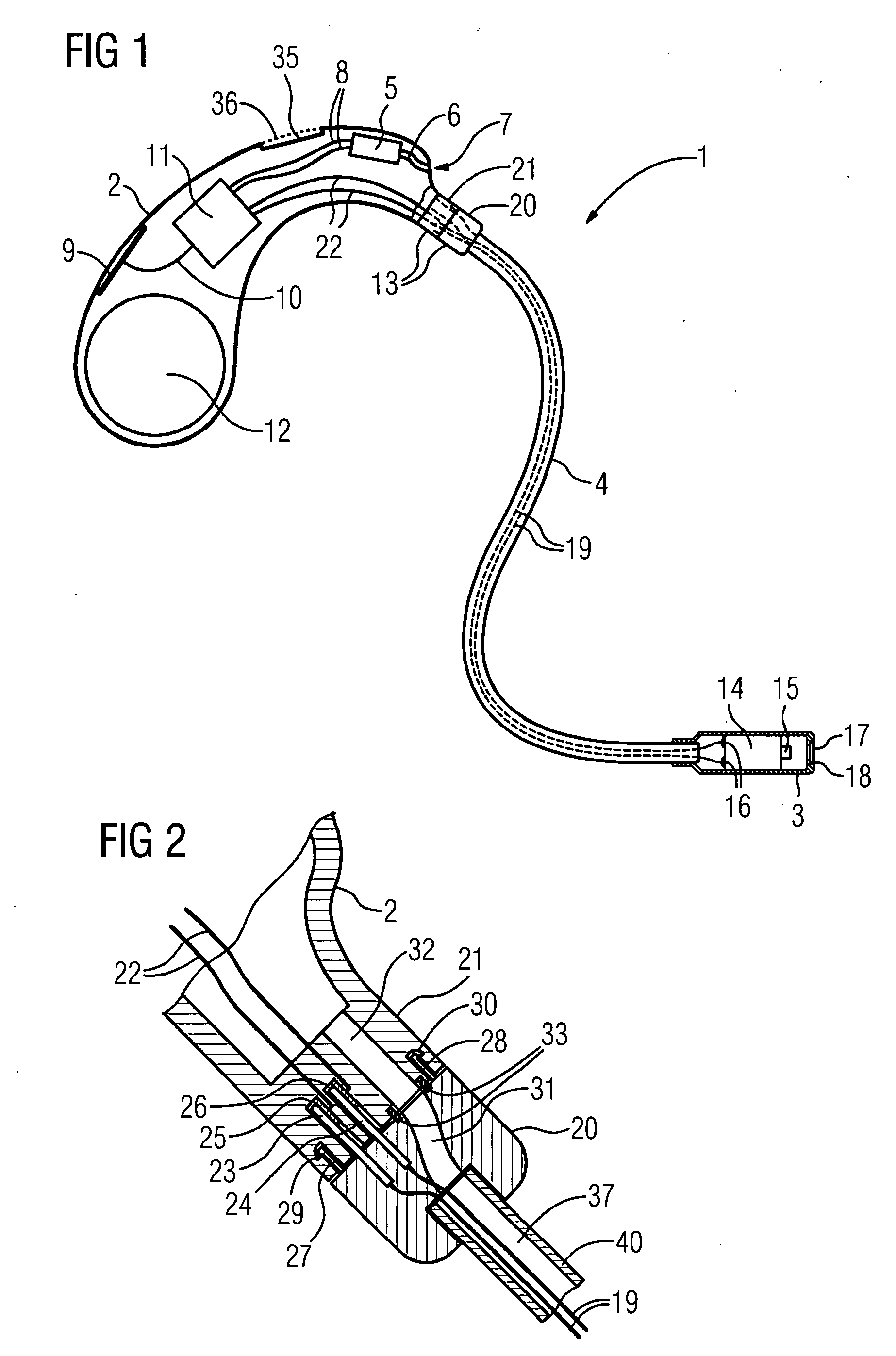 Hearing aid device