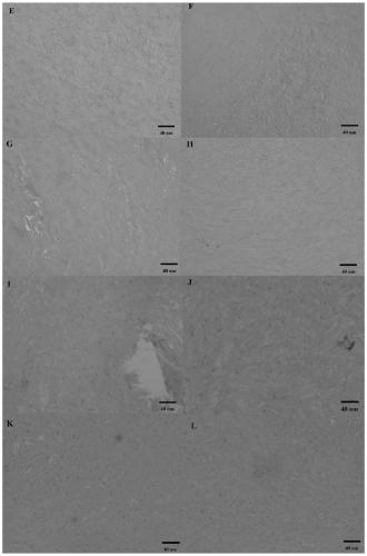 A method for enzymatically and efficiently preparing corneal acellular matrix tissue engineering scaffold