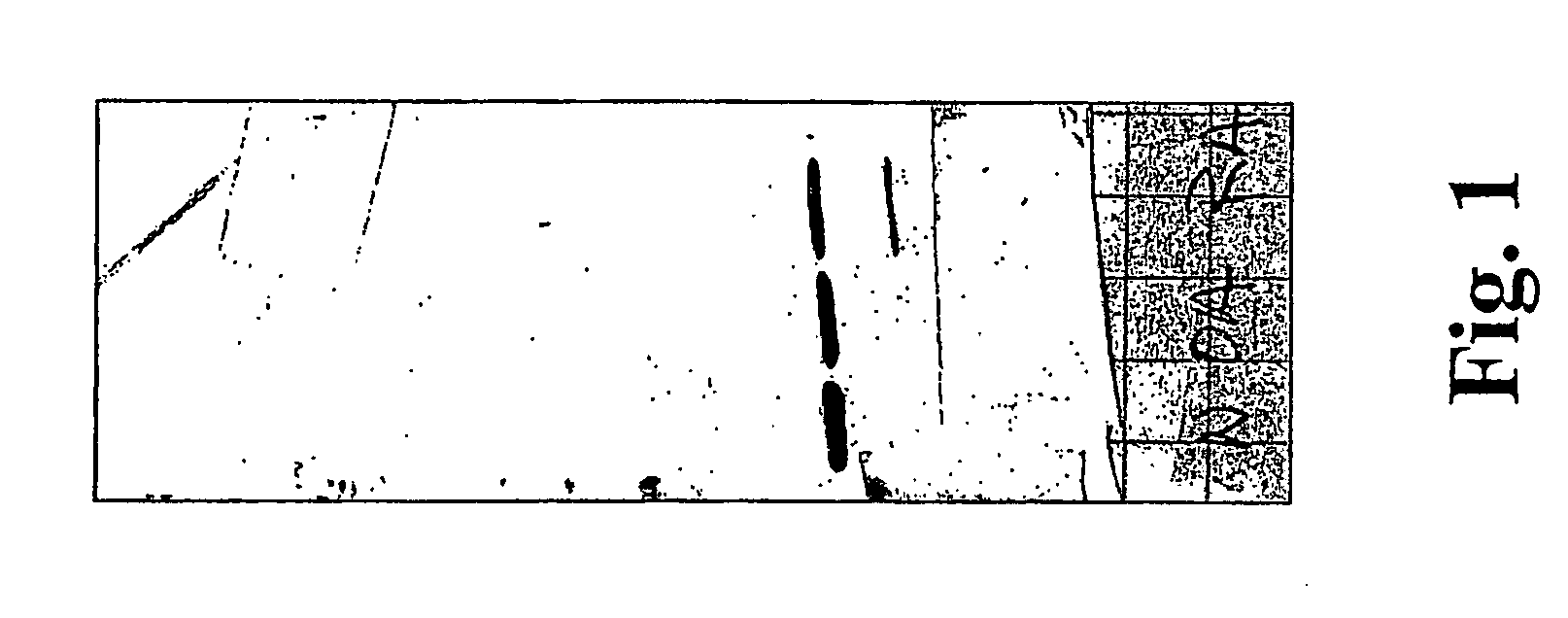 Method for Determining a Tissue Degradation Process by Detection of Comp Neoepitopes