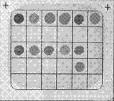 G6PD deficiency disease gene detection kit