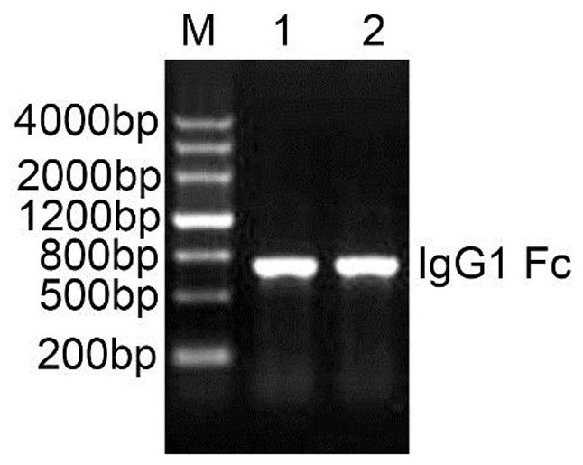 An interleukin-39 specific antagonistic protein and its application in the treatment of autoimmune diseases