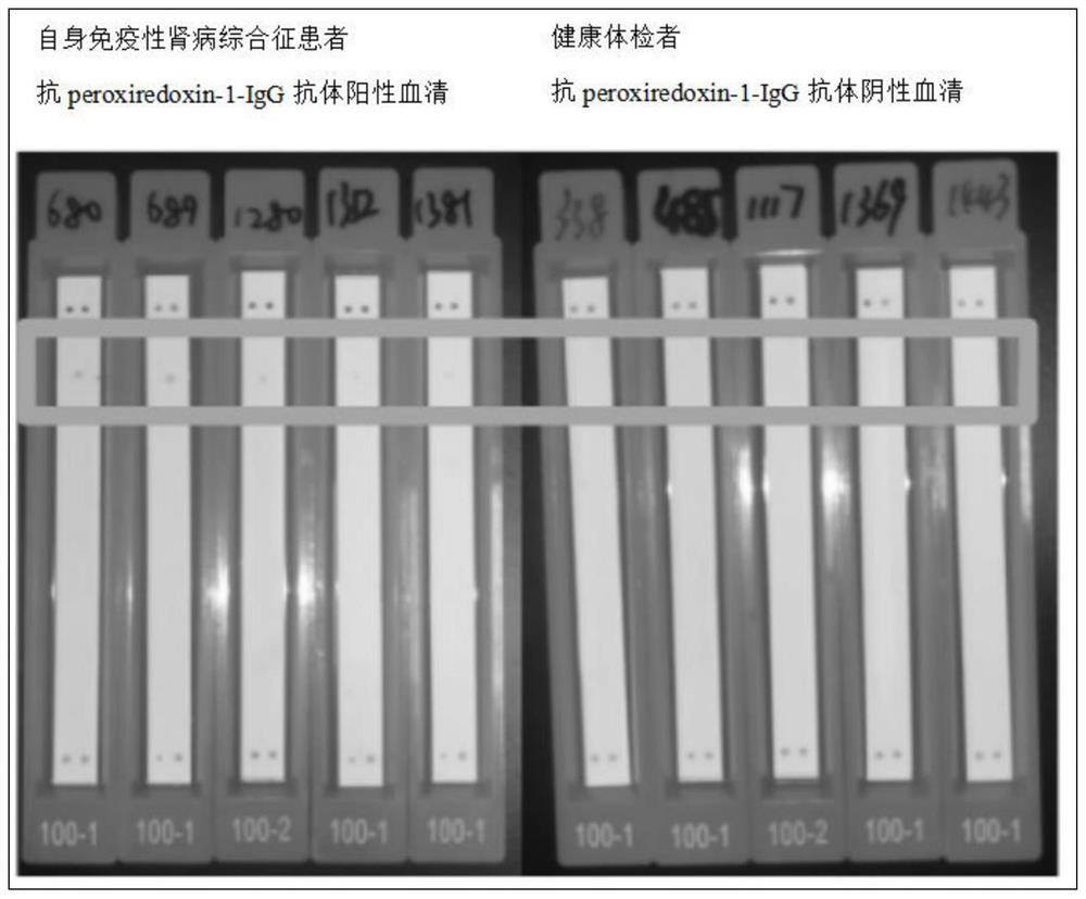 Kit for detecting anti-peroxide reductase 1-IgG antibody