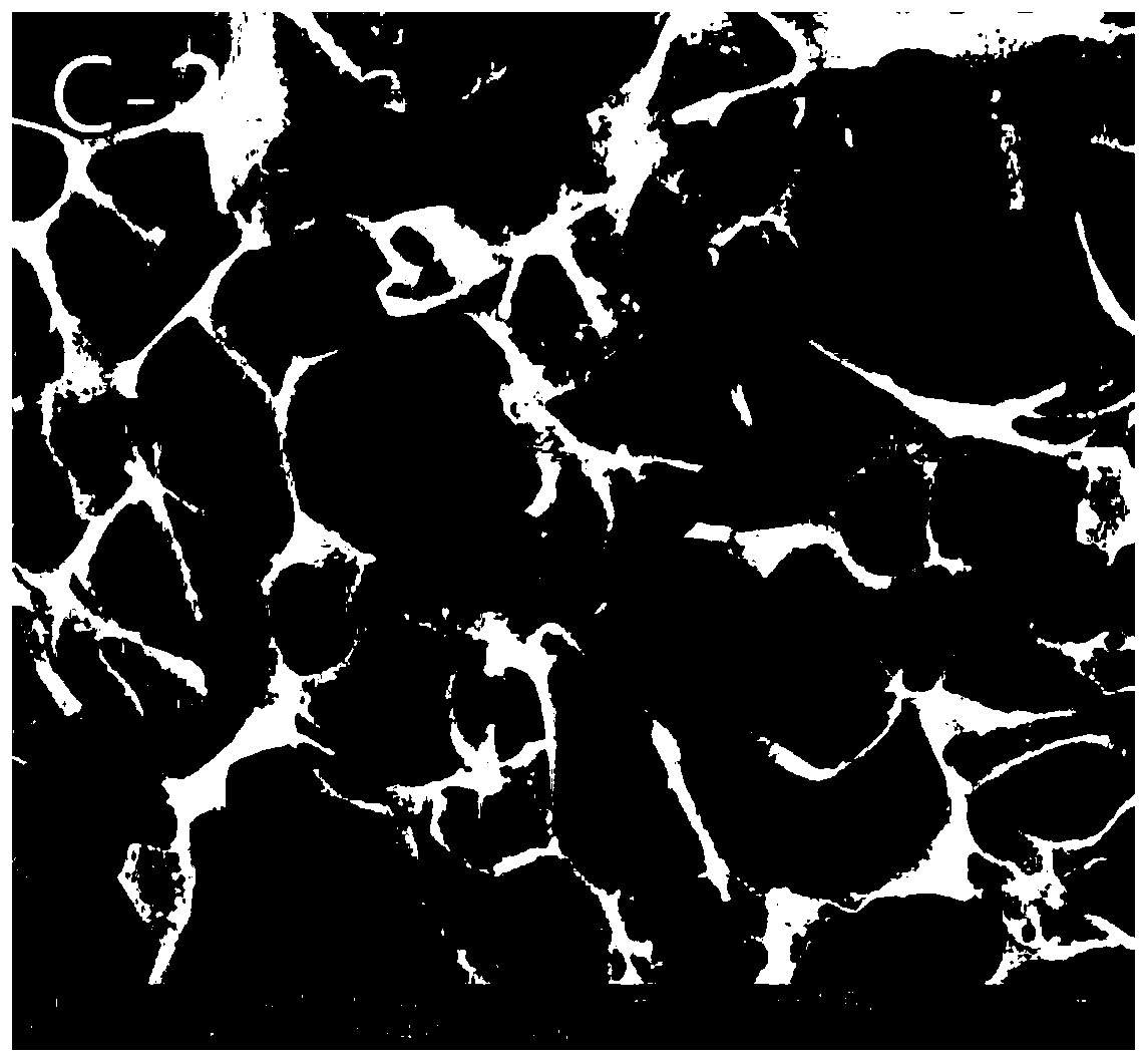 PRP-chitosan-silk fibroin composite material and preparation method therefor