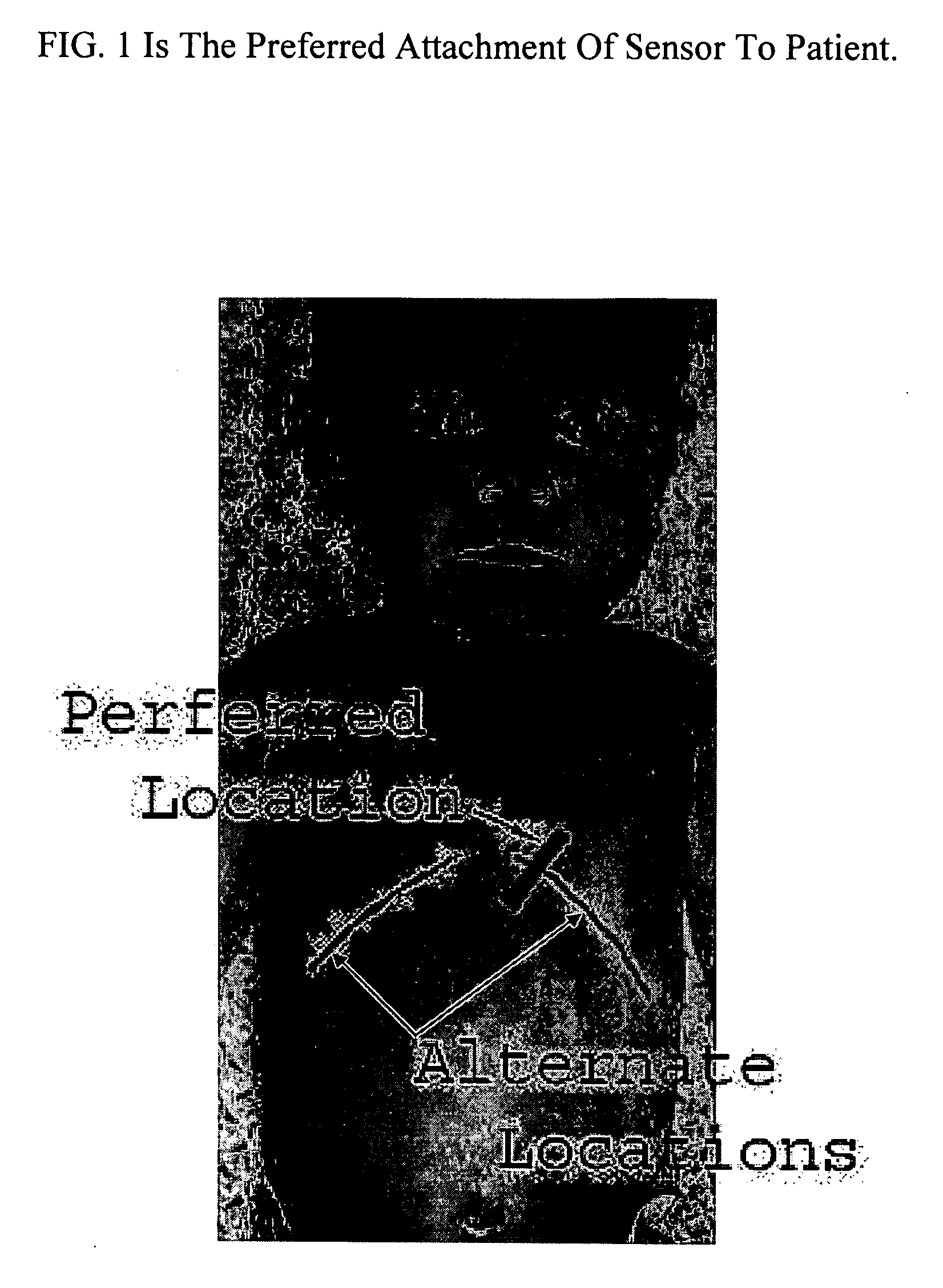 Portable Apnea and Cardiac Monitor