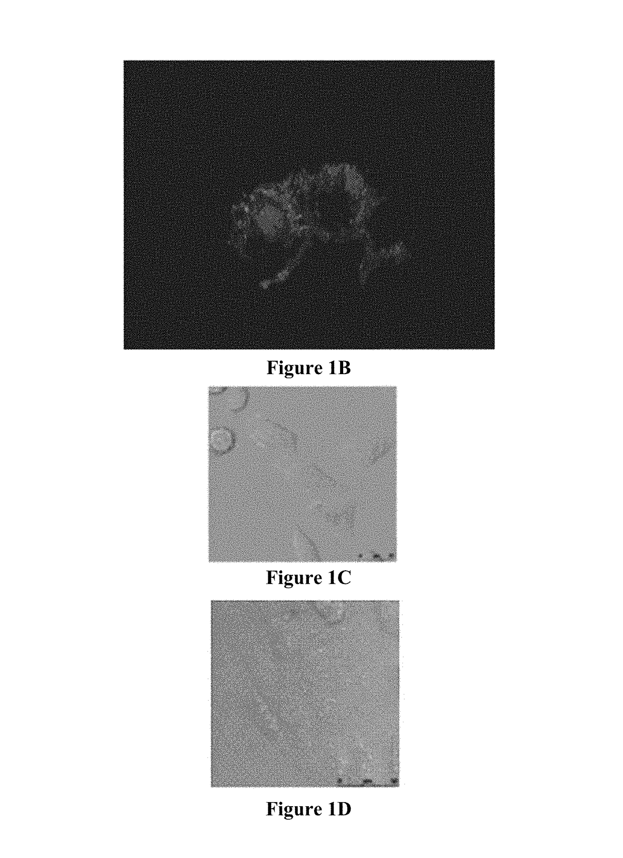 Multi-modal bioprobe for bladder cancer imaging and photodynamic therapy